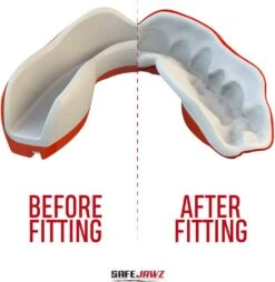 SafeJawz Extro Series Adult/Junior Self -Sports Shop k19e04607e968ede0d19aedf4fa5aac31