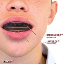 SafeJawz Ortho Series Self -Sports Shop k24193b8177410f0e1bb8a391a58a3fbb