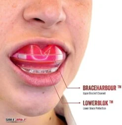 SafeJawz Ortho Series Self -Sports Shop k8669bebb09672d924304387235d5d595