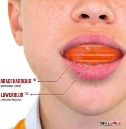 SafeJawz Ortho Series Self -Sports Shop kde3a4f047814ee81d5dc70a61503a4e5